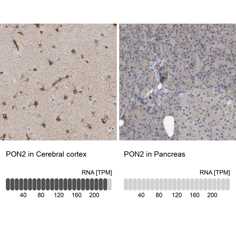 Anti-PON2 Antibody