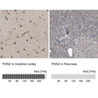 Anti-PON2 Antibody