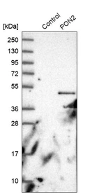 Western blot analysis in control (vector only transfected HEK293T lysate) and PON2 over-expression lysate (Co-expressed with a C-terminal myc-DDK tag (~3.1 kDa) in mammalian HEK293T cells, LY400116).