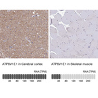 Anti-ATP6V1E1 Antibody