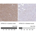 Anti-ATP6V1E1 Antibody