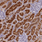 Immunohistochemical staining of human kidney shows strong membranous positivity in cells in tubules.