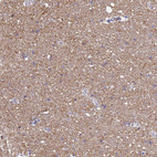 Immunohistochemical staining of human cerebral cortex shows moderate granular cytoplasmic positivity in neuropil.