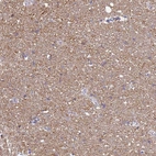Immunohistochemical staining of human cerebral cortex shows moderate granular cytoplasmic positivity in neuropil.