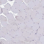 Immunohistochemical staining of human skeletal muscle shows no positivity in myocytes as expected.
