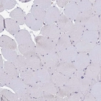Immunohistochemical staining of human skeletal muscle shows no positivity in myocytes as expected.