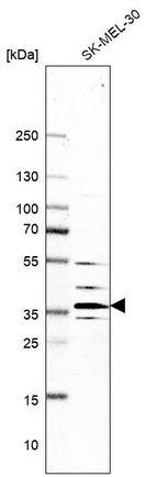 Western blot analysis in human cell line SK-MEL-30.