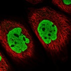 Immunofluorescent staining of human cell line A-431 shows localization to nucleoplasm.