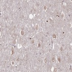 Anti-TBC1D25 Antibody