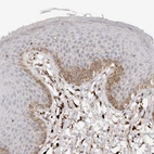 Anti-SERPINH1 Antibody