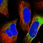 Immunofluorescent staining of human cell line U-2 OS shows positivity in endoplasmic reticulum.