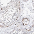 Anti-SNU13 Antibody