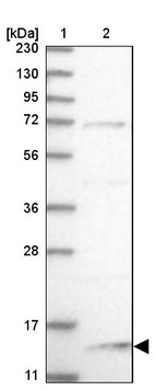 Lane 1: Marker [kDa] 230, 130, 95, 72, 56, 36, 28, 17, 11_br/_Lane 2: Human cell line RT-4