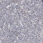 Immunohistochemical staining of human spleen shows moderate granular positivity in cells in red pulp.