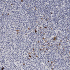 Immunohistochemical staining of human tonsil shows strong granular cytoplasmic positivity in non-germinal center cells.