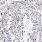 Immunohistochemical staining of human testis shows no positivity in cells in seminiferous ducts as expected.