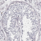 Immunohistochemical staining of human testis shows no positivity in cells in seminiferous ducts as expected.