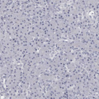 Immunohistochemical staining of human pancreas shows no positivity in exocrine glandular cells as expected.