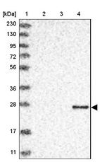 Anti-GZMH Antibody