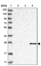 Lane 1: Marker [kDa] 230, 130, 95, 72, 56, 36, 28, 17, 11_br/_Lane 2: Human cell line RT-4_br/_Lane 3: Human cell line U-251MG sp_br/_Lane 4: Human plasma (IgG/HSA depleted)