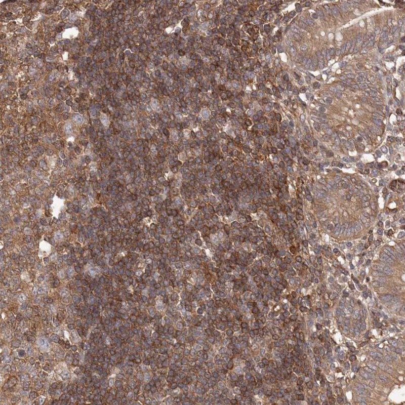 Anti-NFKBIA Antibody