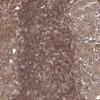 Anti-NFKBIA Antibody