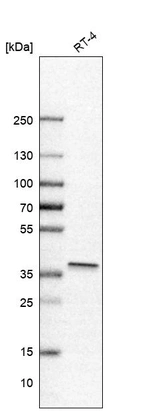 Western blot analysis in human cell line RT-4.