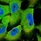 Immunofluorescent staining of human cell line U-251 MG shows localization to cytosol.