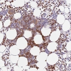 Anti-PPM1A Antibody