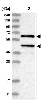 Lane 1: Marker [kDa] 230, 130, 95, 72, 56, 36, 28, 17, 11_br/_Lane 2: Human cell line RT-4