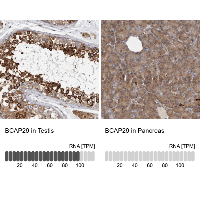 Anti-BCAP29 Antibody