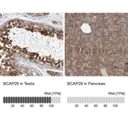 Anti-BCAP29 Antibody