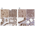 Immunohistochemical staining of human cerebral cortex, pancreas, testis and thyroid gland using Anti-BCAP29 antibody HPA029215 (A) shows similar protein distribution across tissues to independent antibody HPA049694 (B).
