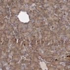 Immunohistochemical staining of human pancreas shows low expression as expected.