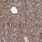 Immunohistochemical staining of human pancreas shows low expression as expected.