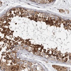 Immunohistochemical staining of human testis shows high expression.