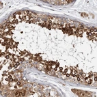 Immunohistochemical staining of human testis shows high expression.