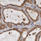 Immunohistochemical staining of human thyroid gland using Anti-BCAP29 antibody HPA029215.