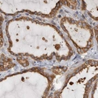 Immunohistochemical staining of human thyroid gland using Anti-BCAP29 antibody HPA029215.