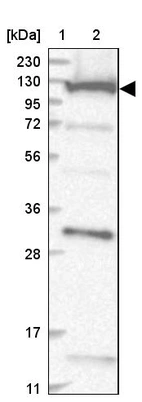 Lane 1: Marker [kDa] 230, 130, 95, 72, 56, 36, 28, 17, 11_br/_Lane 2: Human cell line RT-4