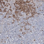Immunohistochemical staining of human tonsil shows strong cytoplasmic positivity in lymphoid cells.
