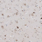 Immunohistochemical staining of human cerebral cortex shows weak to moderate cytoplasmic positivity in neurons.