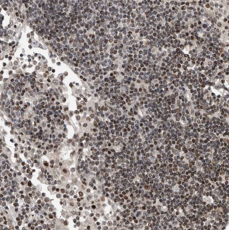 Anti-SNRNP48 Antibody