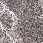 Anti-SNRNP48 Antibody