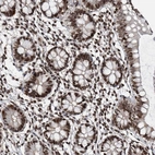 Immunohistochemical staining of human small intestine shows strong nuclear positivity in glandular cells.