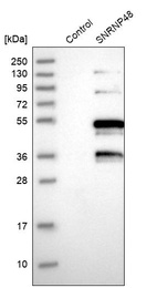 Anti-SNRNP48 Antibody