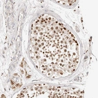 Anti-ZRANB1 Antibody