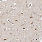 Immunohistochemical staining of human cerebral cortex shows strong cytoplasmic positivity in subset neurons.