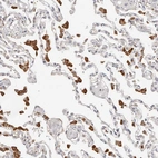 Immunohistochemical staining of human lung shows strong cytoplasmic positivity in macrophages.