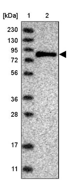 Anti-SENP2 Antibody
